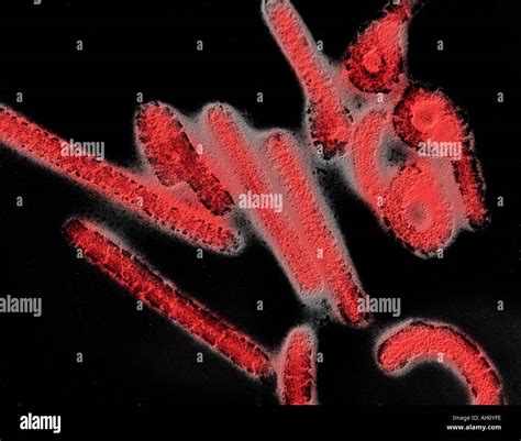 Colorized electron micrograph of Marburg virus particles
