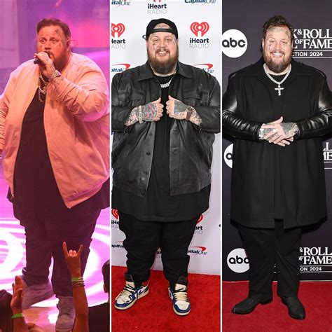 A striking comparison showing Jelly Roll's 200-pound weight loss journey.
